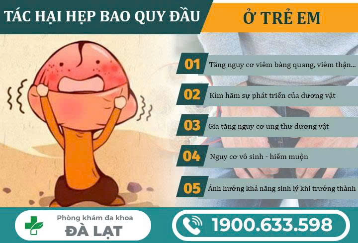 Hình ảnh minh họa